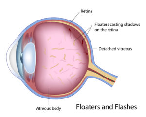 floaters-1366x1038